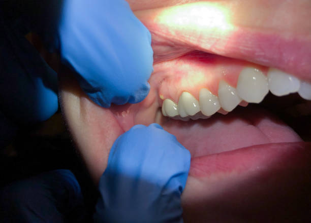 Best Same-Day Emergency Dentist in Speer, NC